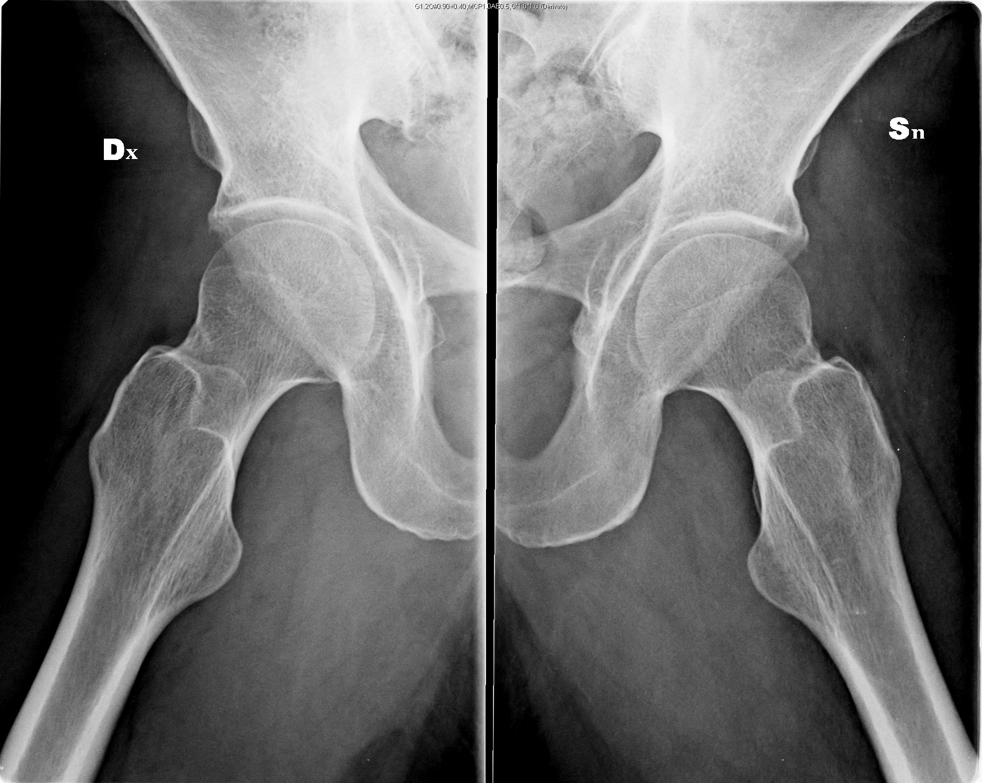 L'esame radiografico dell'anca | Radiologia Ortopedica